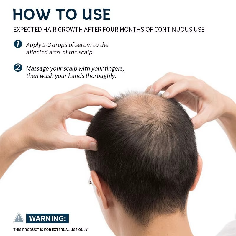 Carvenchy Hair Regrowth Treatment - 5% Spray