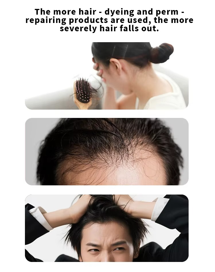 Carvenchy Hair Regrowth Treatment - 5% Spray