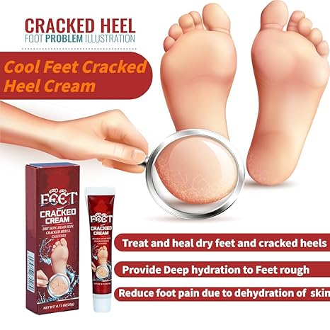 Cracked Heel Repair Cream, 20g Foot Moisturiser Cream for Dry Cracked Heels, Hard and Rough Skin on the Feet, Foot Care Heel Balm, Smoother Feet in 1 Night (Pack of 1)