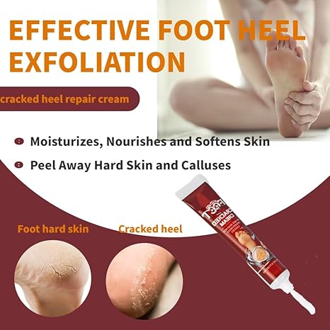 Cracked Heel Repair Cream, 20g Foot Moisturiser Cream for Dry Cracked Heels, Hard and Rough Skin on the Feet, Foot Care Heel Balm, Smoother Feet in 1 Night (Pack of 1)