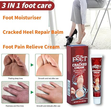 Cracked Heel Repair Cream, 20g Foot Moisturiser Cream for Dry Cracked Heels, Hard and Rough Skin on the Feet, Foot Care Heel Balm, Smoother Feet in 1 Night (Pack of 1)