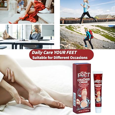 Cracked Heel Repair Cream, 20g Foot Moisturiser Cream for Dry Cracked Heels, Hard and Rough Skin on the Feet, Foot Care Heel Balm, Smoother Feet in 1 Night (Pack of 1)