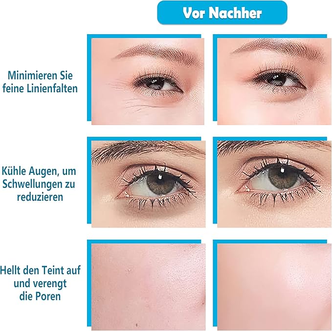 Facial Ice Globes, Pack of 2 Facial Globes for Massage Tools, Facial Roller Massagers for Cold Skin, Tighten the Skin, Reduce Swelling and Dark Circles, Improve Blood Circulation