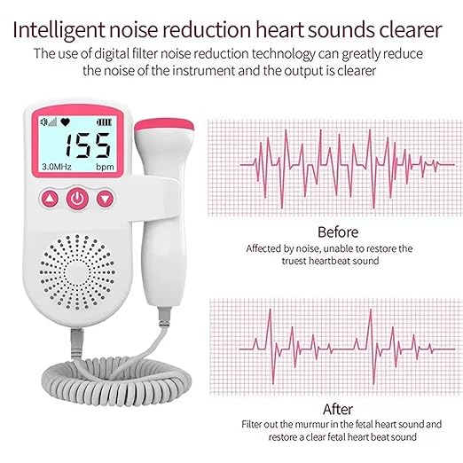 Portable Fetal Doppler Fetal Heart Rate Monitor Home Baby Fetal Heart Doppler Monitor for Pregnancy