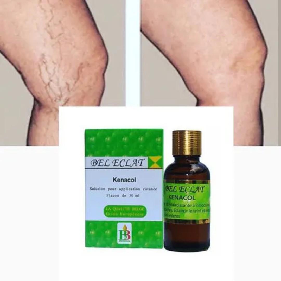 Bel Eclat Kenacol skin treatment oil Fades blemishes, dark spots, and sunspots green veins and stretch marks Lightens and harmonizes skin tone