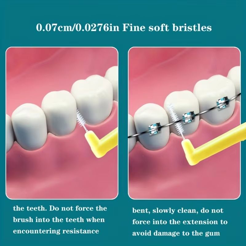 10pcs Angled Interdental Brush For Orthodontic Braces Micro Soft Brush For Dental Brackets Cleaning L Shaped Short Handle Brushes