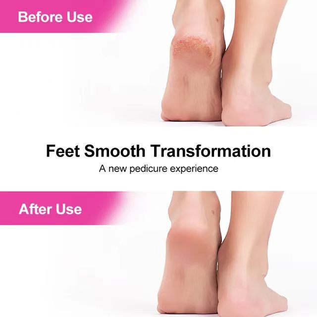 Double Sided Foot File Pedicure Foot Care Tools Dead Skin Callus Remover Stainless Steel Professional