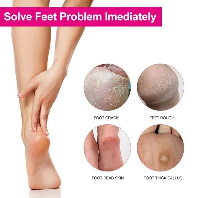 Double Sided Foot File Pedicure Foot Care Tools Dead Skin Callus Remover Stainless Steel Professional