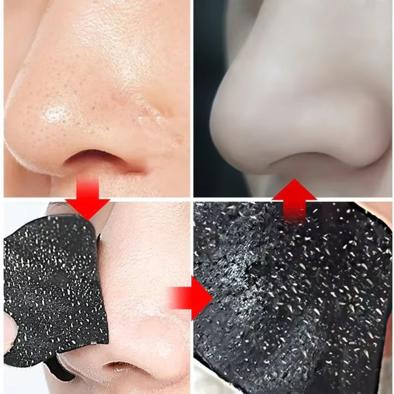 10pcs Nose Strips For Blackheads Acne Removal Instant Pore Unclogging Strips Deep Cleansing Nose Clean Patch New