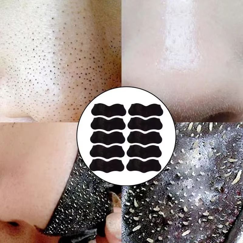 Nose Blackhead Remover Mask Nasal Strips Black Head Nose Dot Spot Peel Skin Care Shrink Pore Black dots Pore Clean Strips