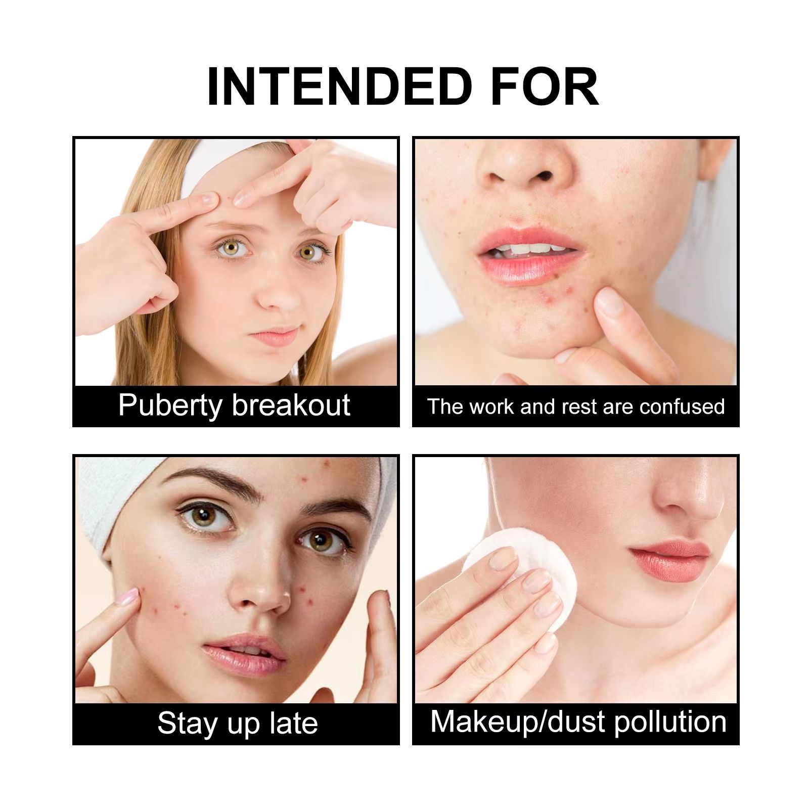 324pcs Patches Star Shape and Heart Shape Cute Black Acne Patch Repair Facial Fade Acne Pimples Closed Heads Remove Blackheads