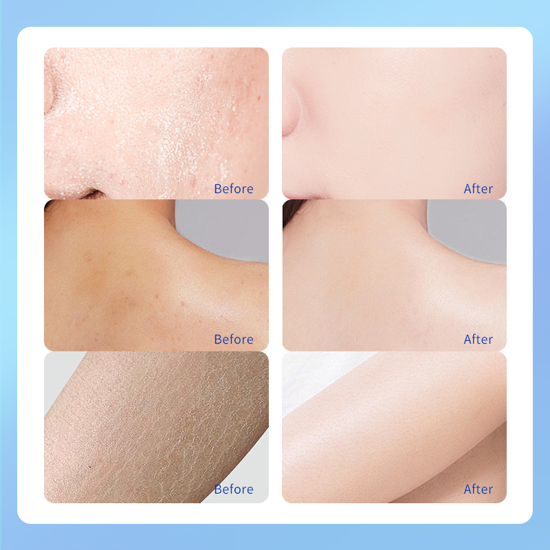 Body and foot whitening exfoliating deep moisturizing cream to solve body and foot cracking whitening 1 bottle 150g