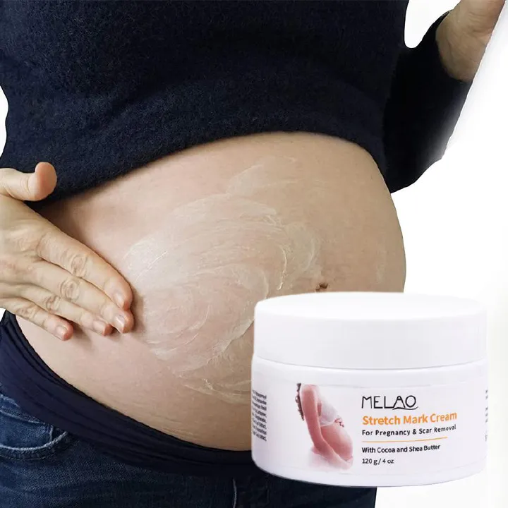 MELAO brand firming and nourishing body care products stretch mark cream fades fine lines postpartum repair 1 bottle 120g