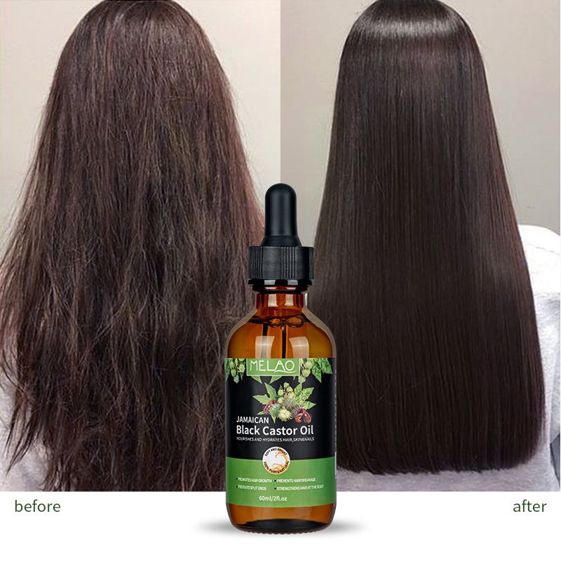Natural castor oil for hair growth, sunburn, other body care, castor oil nourishing moisturizing, anti-aging organic essential oil