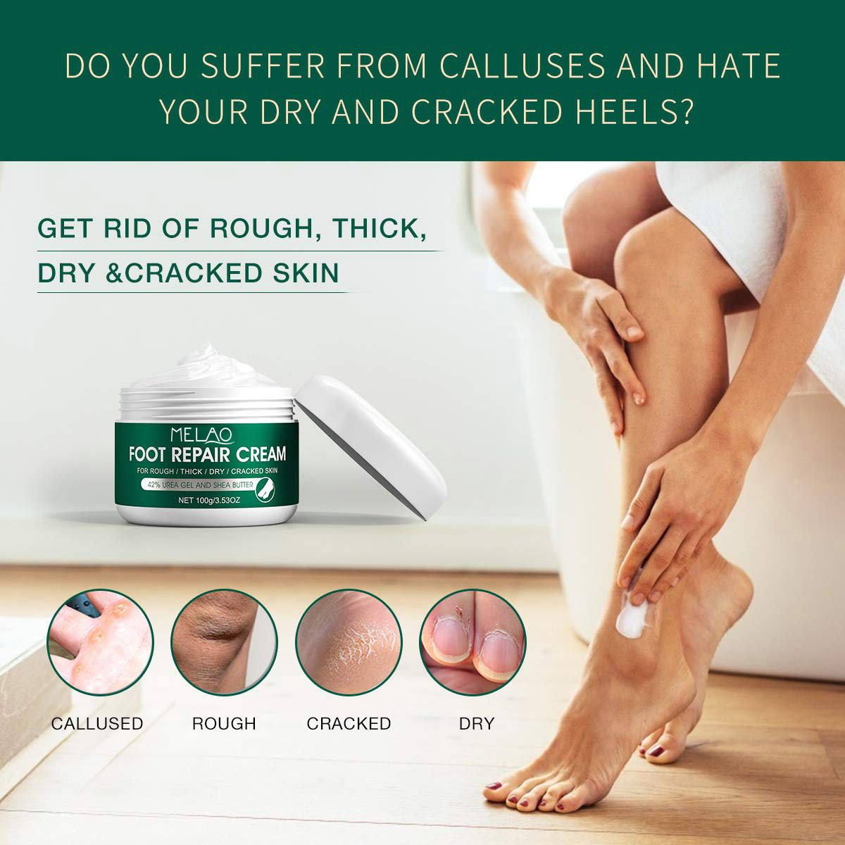 Natural tea tree ointment athlete's foot eczema care cream nail care soothing skin moisturizer for men and women  1 bottle 100g