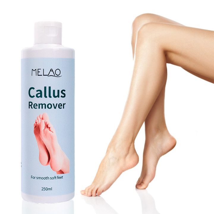 Private Label Organic Foot Peel Exfoliator Gel for Moisturizing Anti Inflammatory Foot Callus Remover  1 bottle 250ml