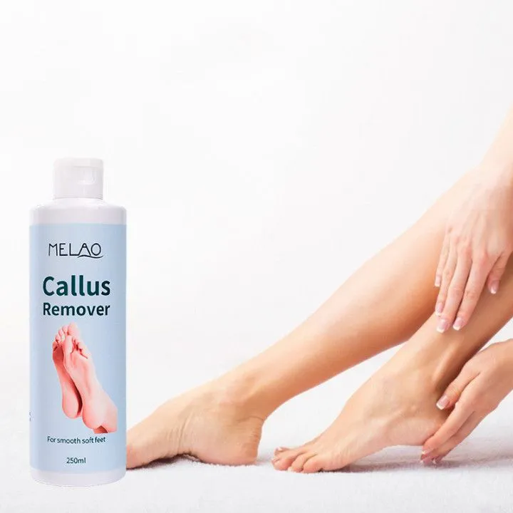Private Label Organic Foot Peel Exfoliator Gel for Moisturizing Anti Inflammatory Foot Callus Remover  1 bottle 250ml