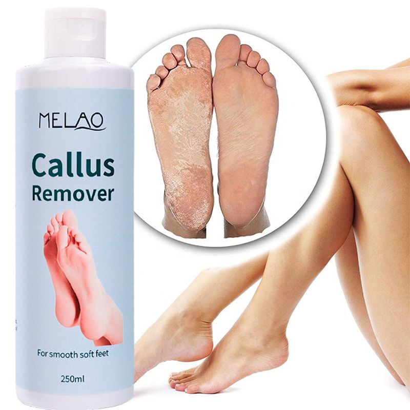 Private Label Organic Foot Peel Exfoliator Gel for Moisturizing Anti Inflammatory Foot Callus Remover  1 bottle 250ml