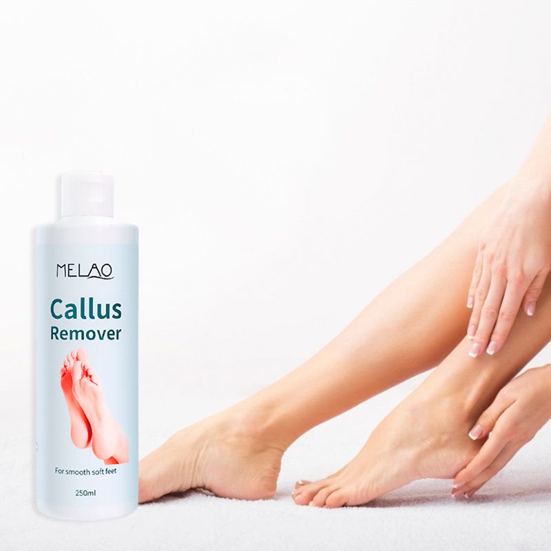 Private Label Organic Foot Peel Exfoliator Gel for Moisturizing Anti Inflammatory Foot Callus Remover  1 bottle 250ml