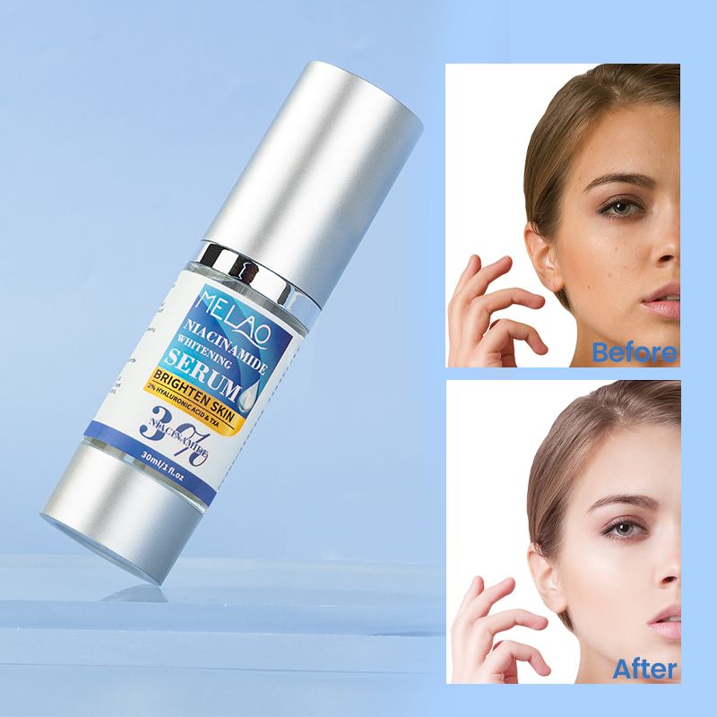Skin Care Niacinamide Serum Melanin Dark Spot Remover Hydrating Brightening Niacinamide Whitening Serums Remove blackheads, remove edema, remove scars