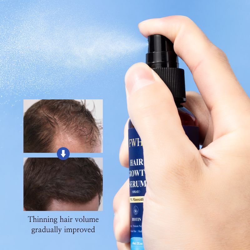 FWH Hair Growth Serum Spray - 5% Minoxidil and Biotin Formula, Promotes Hair Growth and Thicker Hair, Reduces Hair Loss, Nourishes Scalp, 1 bottle 60ml
