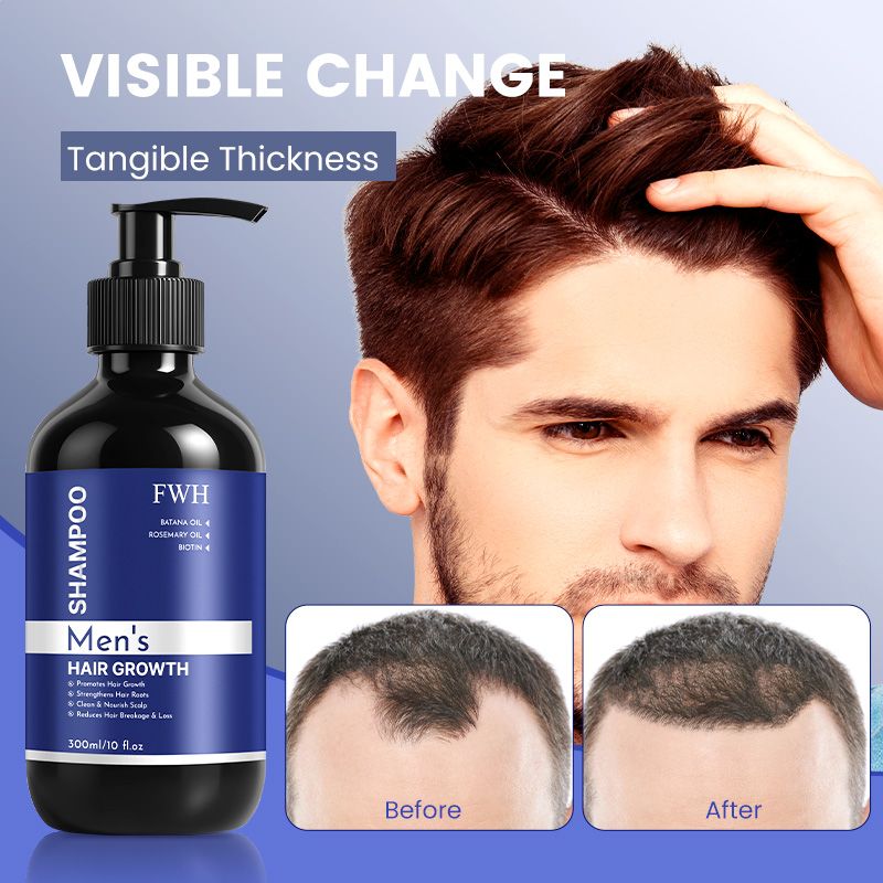 FWH Men's Hair Growth Shampoo - Enriched with Biotin, Argan Oil and Rosemary Oil, with 5% Minoxidil and Biotin - Promotes Follicles for Healthy Hair Growth, 1 Bottle 300ml