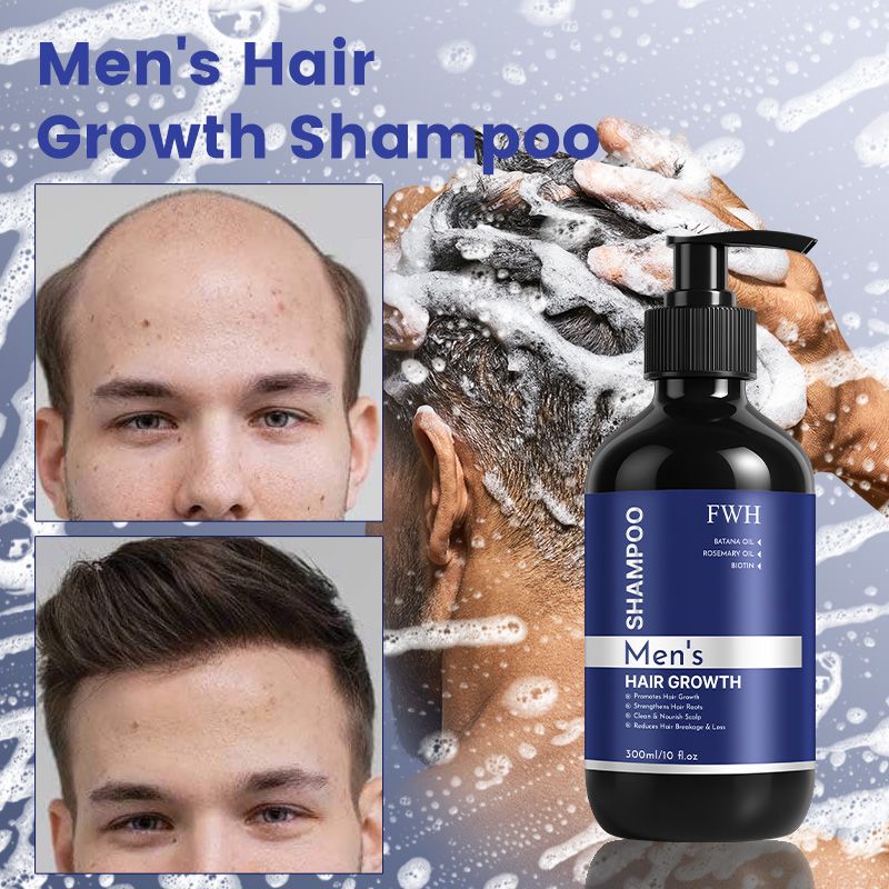 FWH Men's Hair Growth Shampoo - Enriched with Biotin, Argan Oil and Rosemary Oil, with 5% Minoxidil and Biotin - Promotes Follicles for Healthy Hair Growth, 1 Bottle 300ml