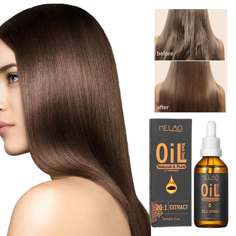 MELAO 20:1 Black Seed Oil - Natural Pure Extract, Suitable for Skin Care and Hair Care, Promotes Hair Growth Nourishes Skin 1 Bottle 60ml