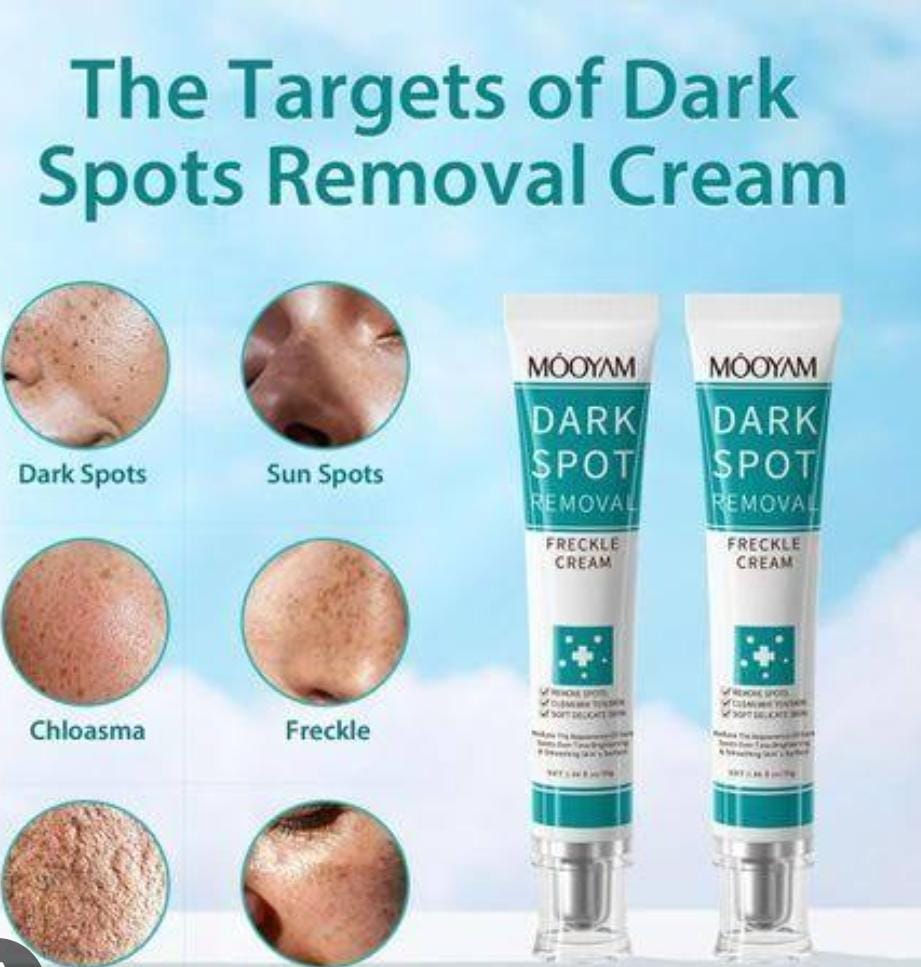 MOOYAM Dark Spot Removal Whitening Freckle Cream