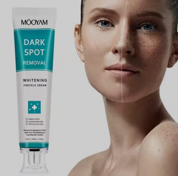 MOOYAM Dark Spot Removal Whitening Freckle Cream