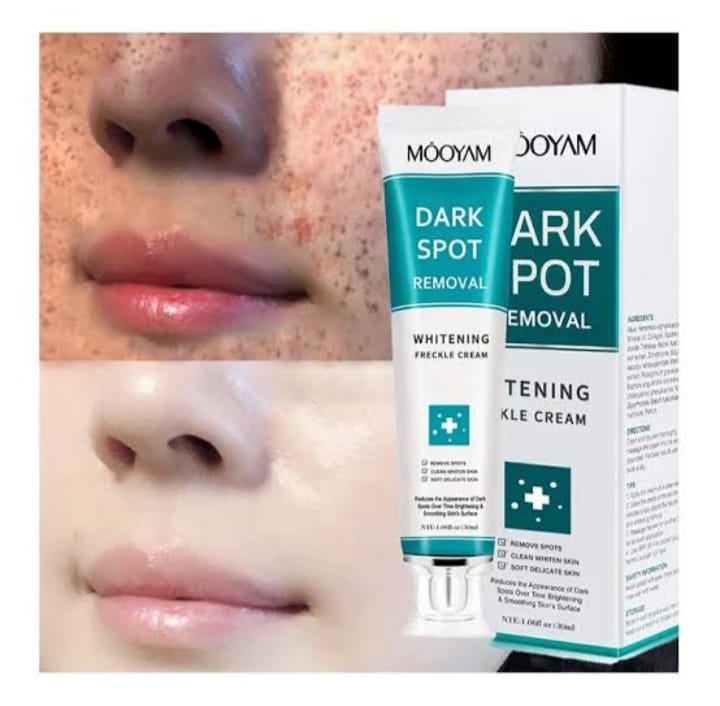 MOOYAM Dark Spot Removal Whitening Freckle Cream