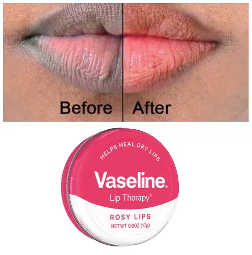 Vaseline Lip Therapy Lip Balm for Dry&Chapped Lips, Rosy Lips for Soft,Pink,Plumper&Naturally Healthy Lips