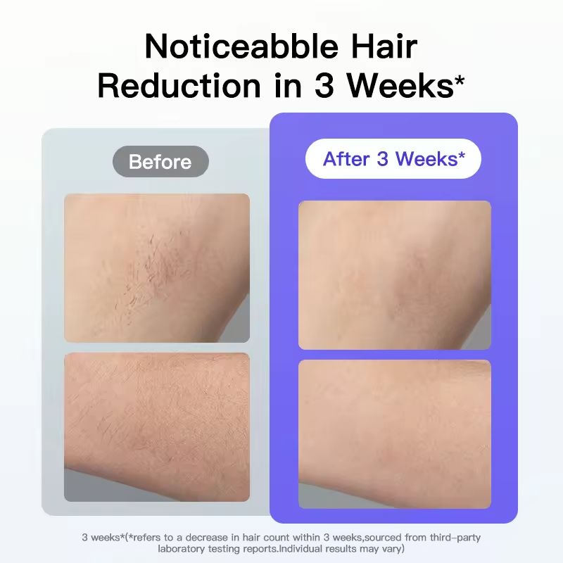 Painless IPL Hair Removal Device with Ice Cooling System, Laser Hair Removal Permanent Hair Removal With Ice-Cooling, At-Home Hair Remover Painless & Long-Lasting Results Best Gifts for Women and Men