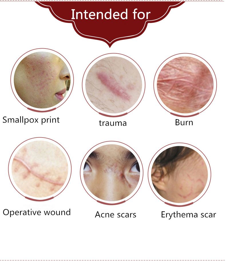 Medical Silicone Scar Gel Scar Cream Burn Burn C-section Scar Removal Cream