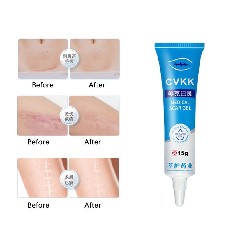 Medical Silicone Scar Gel Scar Cream Burn Burn C-section Scar Removal Cream