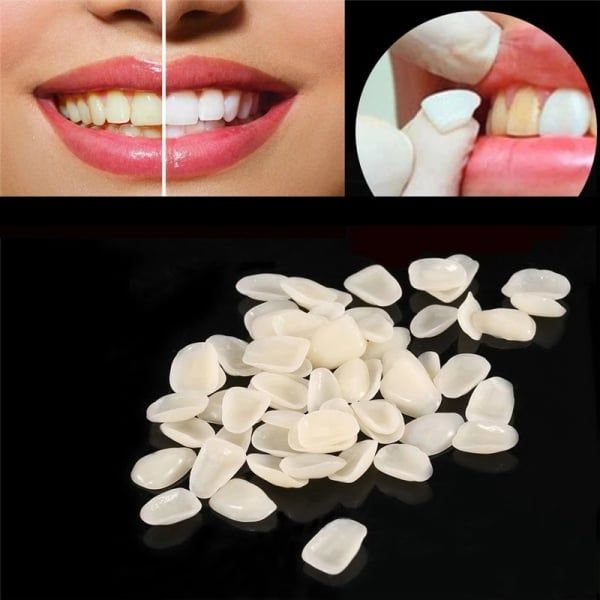 50pcs/bag Dental Ultra-Thin Resin Teeth Veneers Anterior A1 A2 Dental Temporary Crown Teeth Dentist Materials Dental Tools