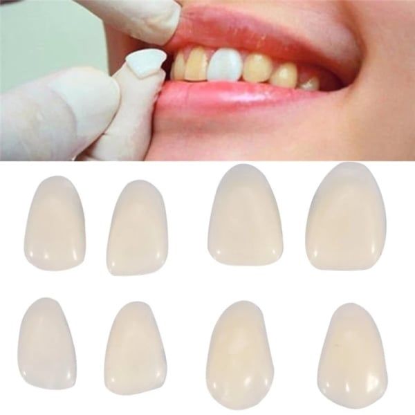 50pcs/bag Dental Ultra-Thin Resin Teeth Veneers Anterior A1 A2 Dental Temporary Crown Teeth Dentist Materials Dental Tools