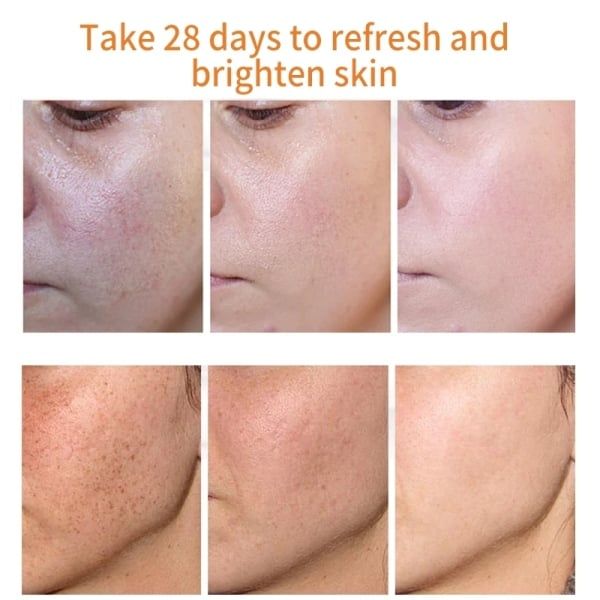 Whitening Freckle Cream Remove Melasma Cream Remove Dark Spots Melanin Melasma Remover Brighten Skin Anti-Aging Skin Lightening