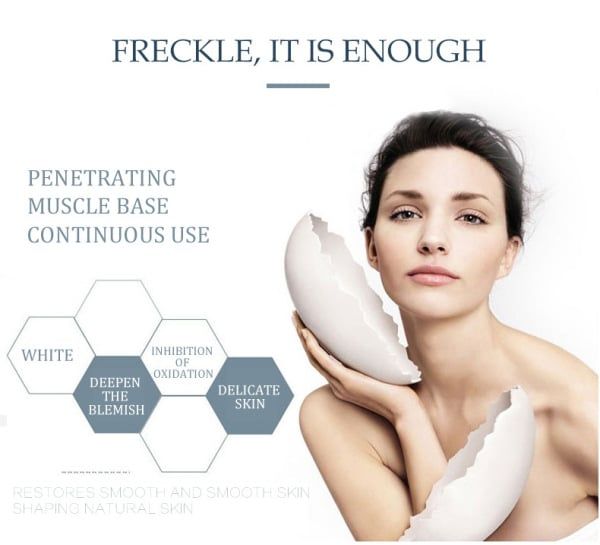 Whitening Freckle Cream Remove Melasma Cream Remove Dark Spots Melanin Melasma Remover Brighten Skin Anti-Aging Skin Lightening