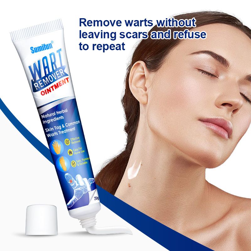 New Wart Removal Body Warts Treatment Cream Foot Care Cream Skin Tag Remover Foot Corn Removal Plantar Warts Ointment