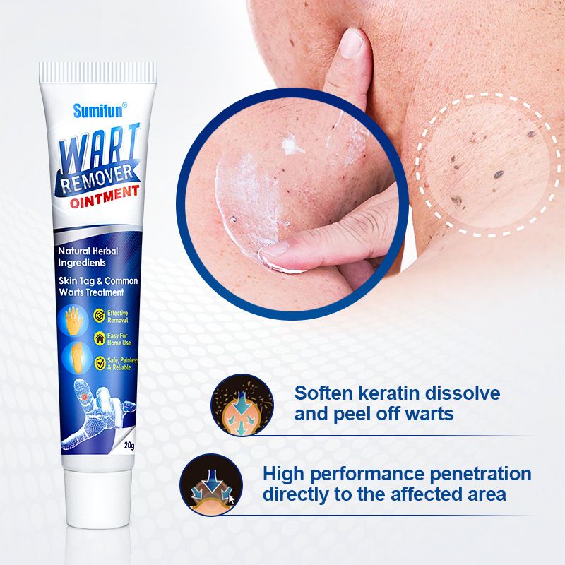 New Wart Removal Body Warts Treatment Cream Foot Care Cream Skin Tag Remover Foot Corn Removal Plantar Warts Ointment