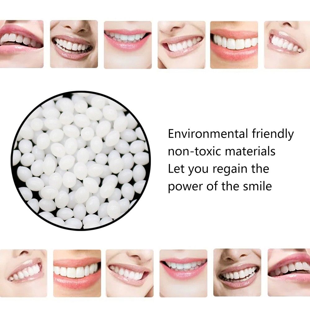 10g Temporary Tooth Repair Kit Teeth And Gaps FalseTeeth Solid Glue Denture Adhesive Teeth Whitening Tooth Beauty Tool #T