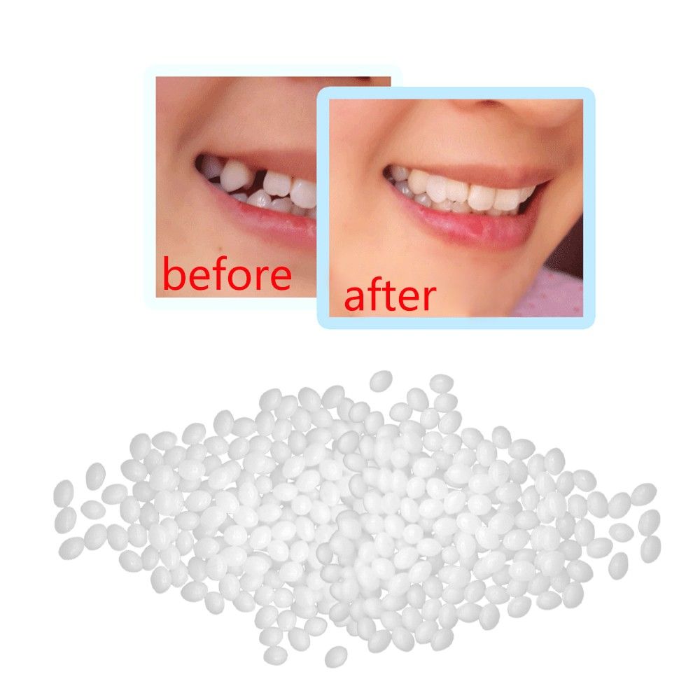 10g Temporary Tooth Repair Kit Teeth And Gaps FalseTeeth Solid Glue Denture Adhesive Teeth Whitening Tooth Beauty Tool #T