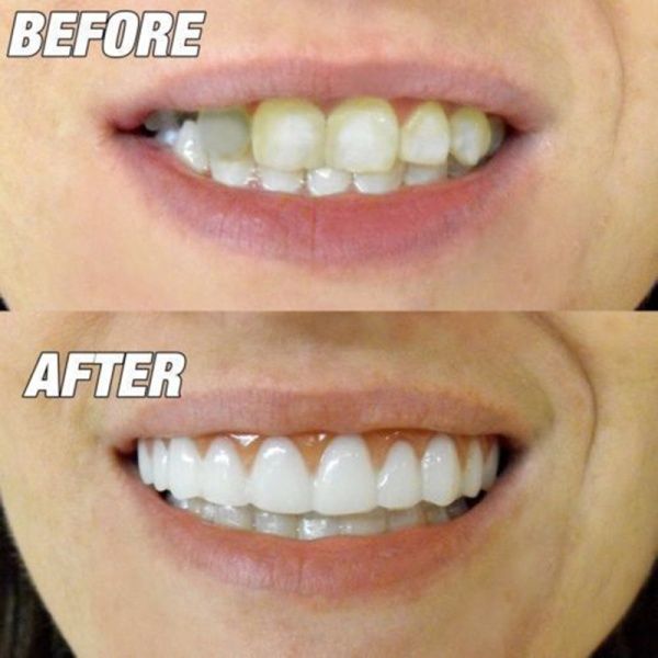 Perfect Instant Smile Comfort Fit Flex Teeth Whitening Denture Paste False Teeth Upper Cosmetic Veneer Tooth Cover Beauty Tool