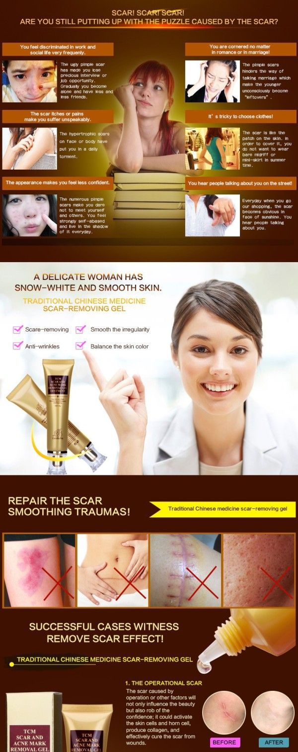 LANBENA Acne Scar Removal Cream Skin Repair Face Cream Acne Spots Acne Treatment Blackhead Whitening Cream Stretch Marks 30ml