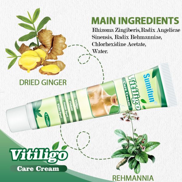 20g Vitiligo Treatment Cream White Spot Antibacterial Ointment Localized Leukoplakia Repair Medical Herbs Beauty Health
