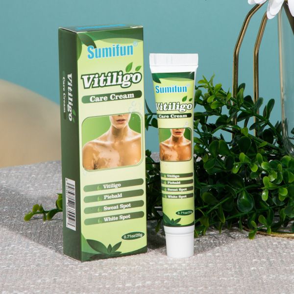 20g Vitiligo Treatment Cream White Spot Antibacterial Ointment Localized Leukoplakia Repair Medical Herbs Beauty Health