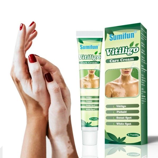 20g Vitiligo Treatment Cream White Spot Antibacterial Ointment Localized Leukoplakia Repair Medical Herbs Beauty Health