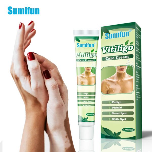 20g Vitiligo Treatment Cream White Spot Antibacterial Ointment Localized Leukoplakia Repair Medical Herbs Beauty Health