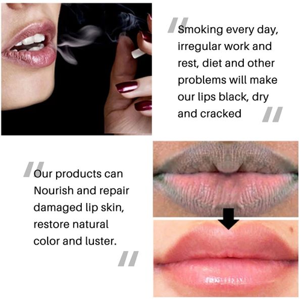 Lip Black Removal Lip Balm Pink Lip Lightening Melanin Fade Lip Balm Moisturizing Lip Brighten Cream Lip Care Makeup Beauty